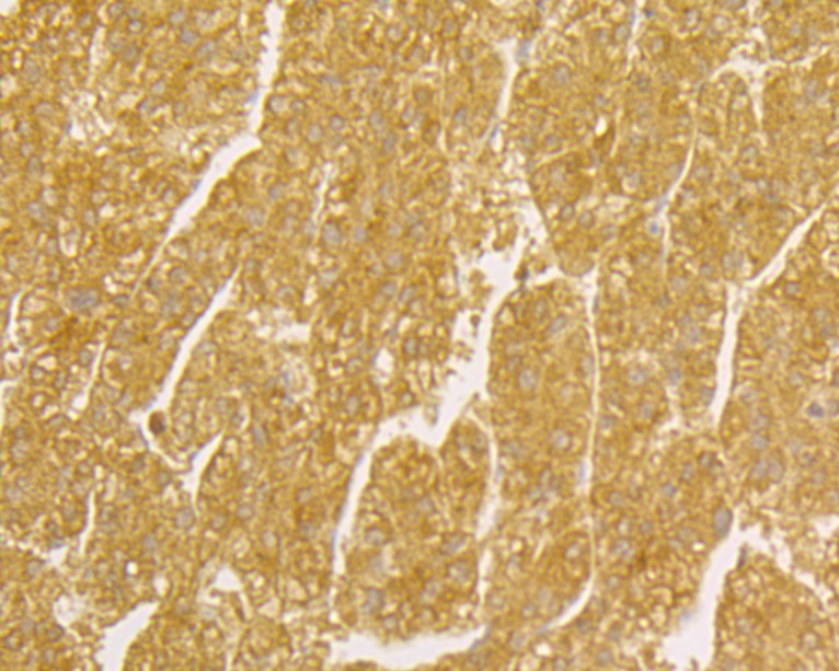 Fig4: Immunohistochemical analysis of paraffin-embedded human liver intestine tissue using anti-Osteoprotegerin antibody. Counter stained with hematoxylin.