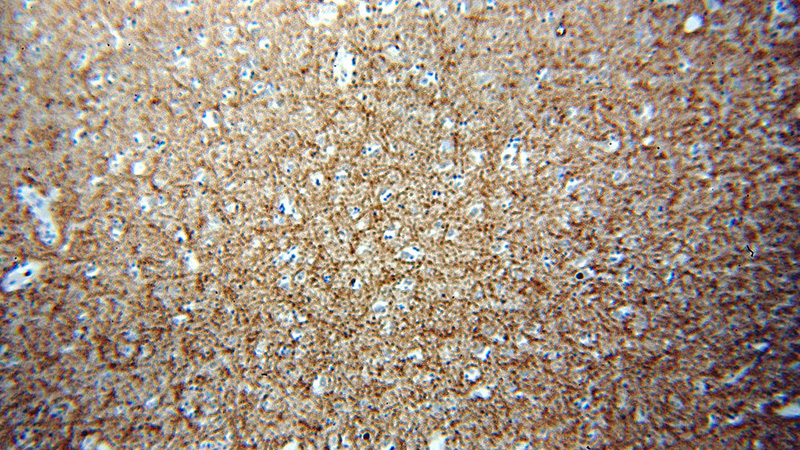 Immunohistochemical of paraffin-embedded human brain using Catalog No:113690(PCDH11X antibody) at dilution of 1:50 (under 10x lens)