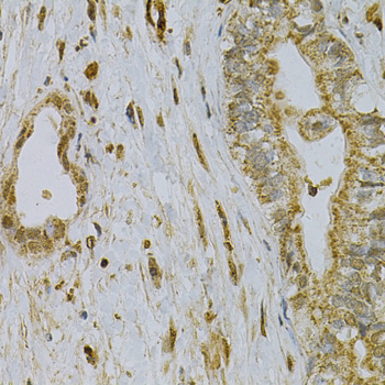 Immunohistochemistry - CDA Polyclonal Antibody 