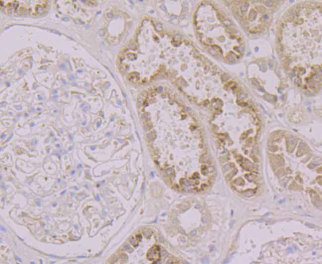 Fig2:; Immunohistochemical analysis of paraffin-embedded human kidney tissue using anti-LRG1 antibody. The section was pre-treated using heat mediated antigen retrieval with Tris-EDTA buffer (pH 9.0) for 20 minutes.The tissues were blocked in 1% BSA for 30 minutes at room temperature, washed with ddH; 2; O and PBS, and then probed with the primary antibody ( 1/50) for 30 minutes at room temperature. The detection was performed using an HRP conjugated compact polymer system. DAB was used as the chromogen. Tissues were counterstained with hematoxylin and mounted with DPX.