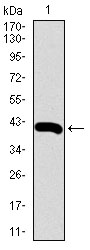 Western blot analysis using SDC1 mAb against human SDC1 (AA