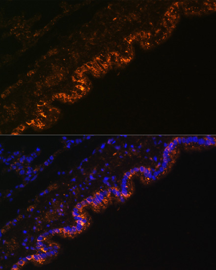 Immunofluorescence - SCNN1A Polyclonal Antibody 