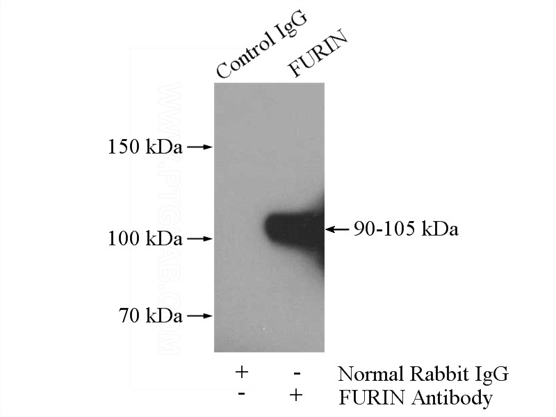IP Result of anti-FURIN (IP:Catalog No:110794, 4ug; Detection:Catalog No:110794 1:500) with HeLa cells lysate 1400ug.