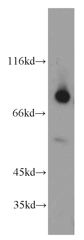 Y79 cells were subjected to SDS PAGE followed by western blot with Catalog No:108835(CAPN2 antibody) at dilution of 1:200