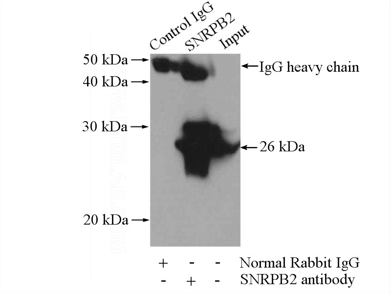 IP Result of anti-SNRPB2 (IP:Catalog No:115459, 4ug; Detection:Catalog No:115459 1:1000) with mouse liver tissue lysate 4000ug.