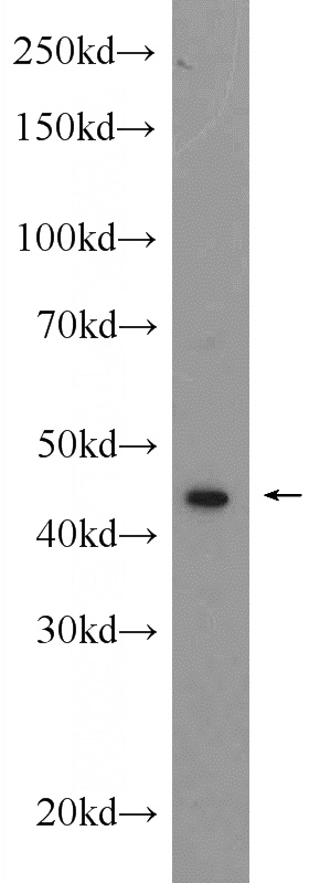 rat brain tissue were subjected to SDS PAGE followed by western blot with Catalog No:114696(RPL4 Antibody) at dilution of 1:1000