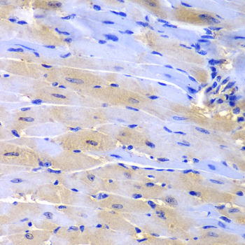 Immunohistochemistry - CUL2 Polyclonal Antibody 