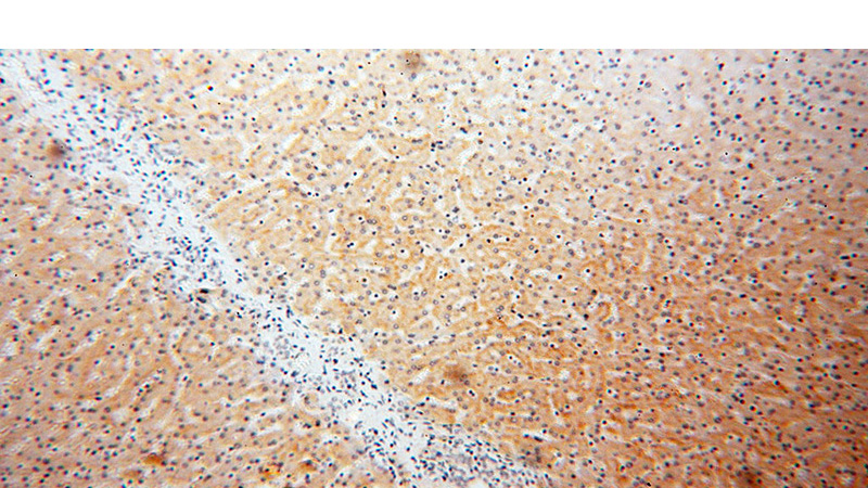 Immunohistochemical of paraffin-embedded human liver using Catalog No:112266(LTF antibody) at dilution of 1:50 (under 10x lens)