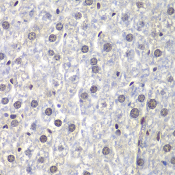 Immunohistochemistry - U2AF1 Polyclonal Antibody 