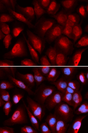 Immunofluorescence - MCM5 Polyclonal Antibody 