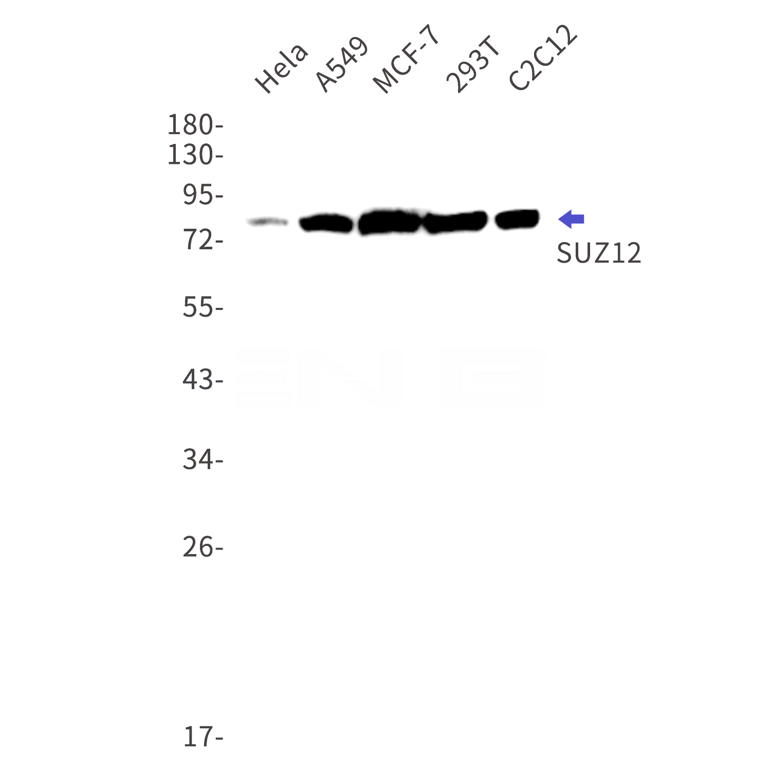 Western blot detection of SUZ12 in Hela,A549,MCF-7,293T,C2C12 cell lysates using SUZ12 Rabbit mAb(1:1000 diluted).Predicted band size:83kDa.Observed band size:83kDa.