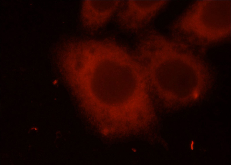 Immunofluorescent analysis of MCF-7 cells using Catalog No:113116(NET1 Antibody) at dilution of 1:50 and Rhodamine-labeled goat anti-rabbit IgG (red)