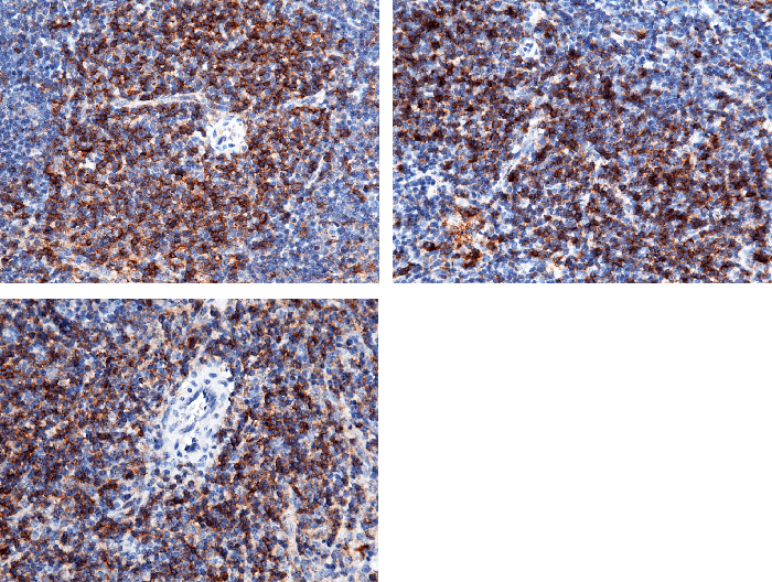 CD4 Antibody, Rabbit MAb, Immunohistochemistry