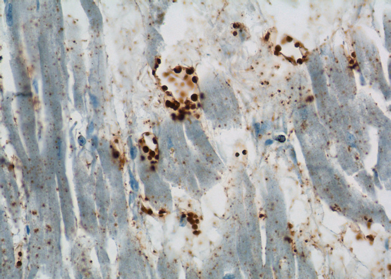Immunohistochemistry of paraffin-embedded human heart tissue slide using Catalog No:117191(BLVRB Antibody) at dilution of 1:50 (under 40x lens)