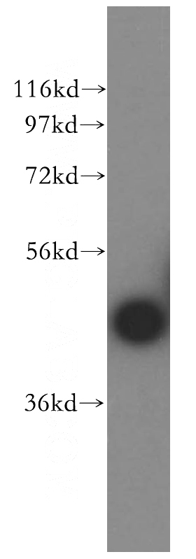mouse eye tissue were subjected to SDS PAGE followed by western blot with Catalog No:108746(CA14 antibody) at dilution of 1:400