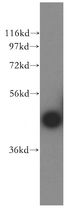 mouse eye tissue were subjected to SDS PAGE followed by western blot with Catalog No:108746(CA14 antibody) at dilution of 1:400