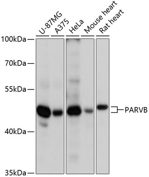 Western blot - PARVB Polyclonal Antibody 