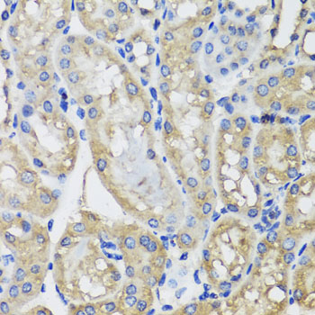 Immunohistochemistry - MRPS22 Polyclonal Antibody 