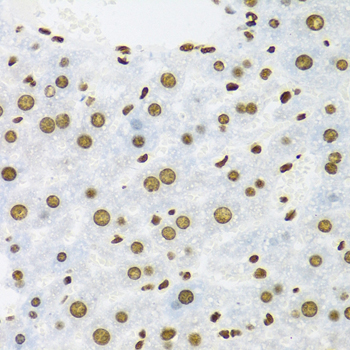 Immunohistochemistry - KHDRBS1 Polyclonal Antibody 