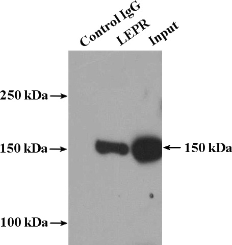 IP Result of anti-LEPR (IP:Catalog No:112197, 5ug; Detection:Catalog No:112197 1:700) with mouse heart tissue lysate 4000ug.