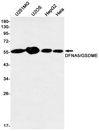 Western blot detection of DFNA5/GSDME in U251MG,U2OS,HepG2,Hela cell lysates using DFNA5/GSDME Rabbit mAb(1:500 diluted).Predicted band size:55kDa.Observed band size:55kDa.