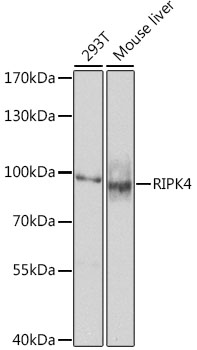 Western blot - RIPK4 Polyclonal Antibody 