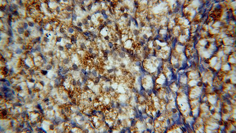 Immunohistochemical of paraffin-embedded human ovary using Catalog No:114153(PPP1R15B;CReP antibody) at dilution of 1:100 (under 40x lens)