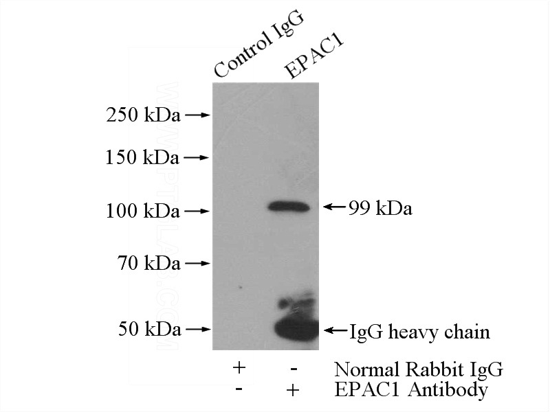 IP Result of anti-RAPGEF3 (IP:Catalog No:110340, 4ug; Detection:Catalog No:110340 1:600) with mouse kidney tissue lysate 4800ug.