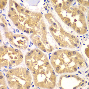 Immunohistochemistry - PRKAG3 Polyclonal Antibody 