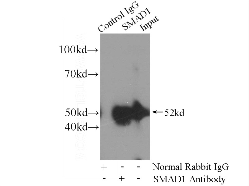 IP Result of anti-SMAD1 (IP:Catalog No:115415, 4ug; Detection:Catalog No:115415 1:500) with mouse heart tissue lysate 8000ug.