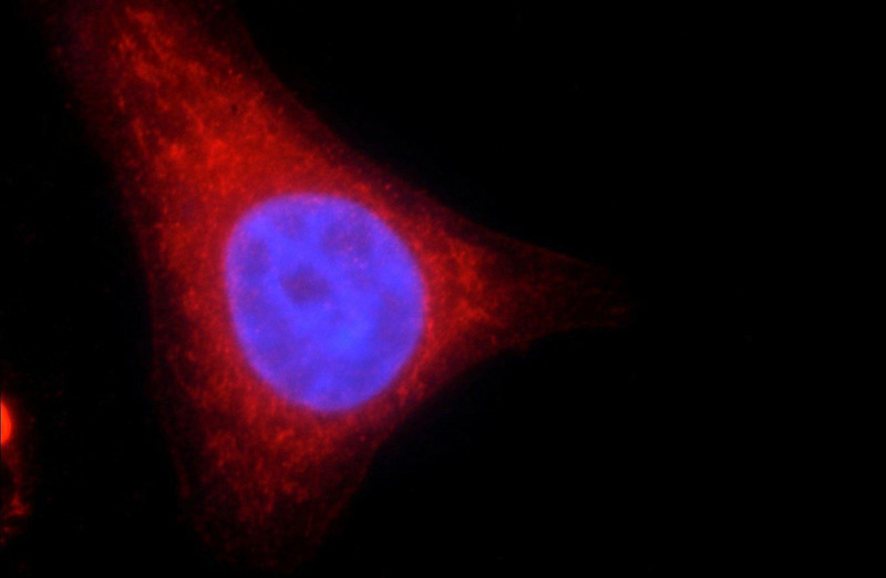 Immunofluorescent analysis of HepG2 cells using Catalog No:114732(RNASEL Antibody) at dilution of 1:25 and Rhodamine-Goat anti-Rabbit IgG