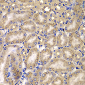 Immunohistochemistry - CARD10 Polyclonal Antibody 