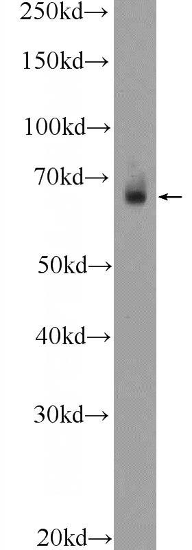 mouse colon tissue were subjected to SDS PAGE followed by western blot with Catalog No:115932(TEAD2 Antibody) at dilution of 1:300