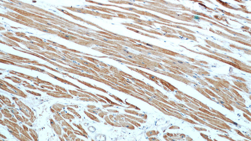 Immunohistochemistry of paraffin-embedded human heart slide using Catalog No:107319(MYL2 Antibody) at dilution of 1:50