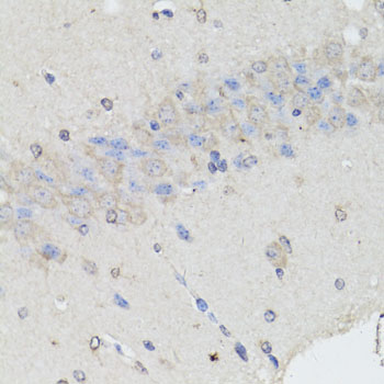 Immunohistochemistry - CHGA Polyclonal Antibody 