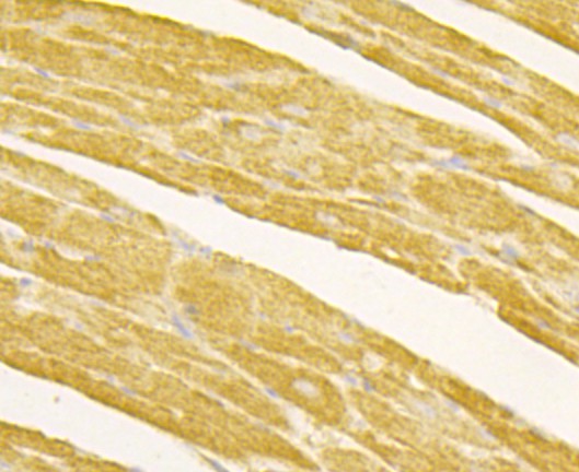 Fig6: Immunohistochemical analysis of paraffin-embedded mouse heart tissue using anti-Osteoprotegerin antibody. Counter stained with hematoxylin.