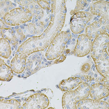 Immunohistochemistry - MSLN Polyclonal Antibody 