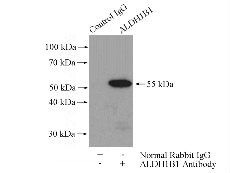 IP Result of anti-ALDH1B1 (IP:Catalog No:107963, 4ug; Detection:Catalog No:107963 1:500) with mouse brain tissue lysate 4000ug.