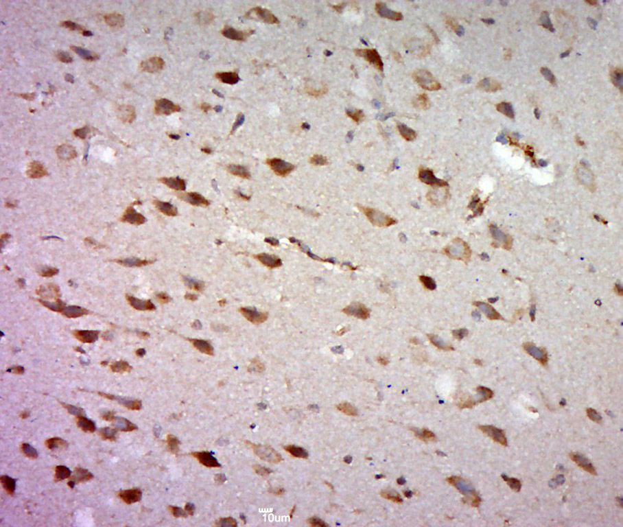 Fig2: Paraformaldehyde-fixed, paraffin embedded (Rat brain); Antigen retrieval by boiling in sodium citrate buffer (pH6.0) for 15min; Block endogenous peroxidase by 3% hydrogen peroxide for 20 minutes; Blocking buffer (normal goat serum) at 37℃ for 30min; Antibody incubation with (FSD1L) Polyclonal Antibody, Unconjugated at 1:500 overnight at 4℃, followed by a conjugated secondary (sp-0023) for 20 minutes and DAB staining.