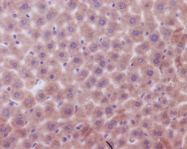 Immunohistochemical analysis of paraffin-embedded mouse liver, using Bak Antibody.