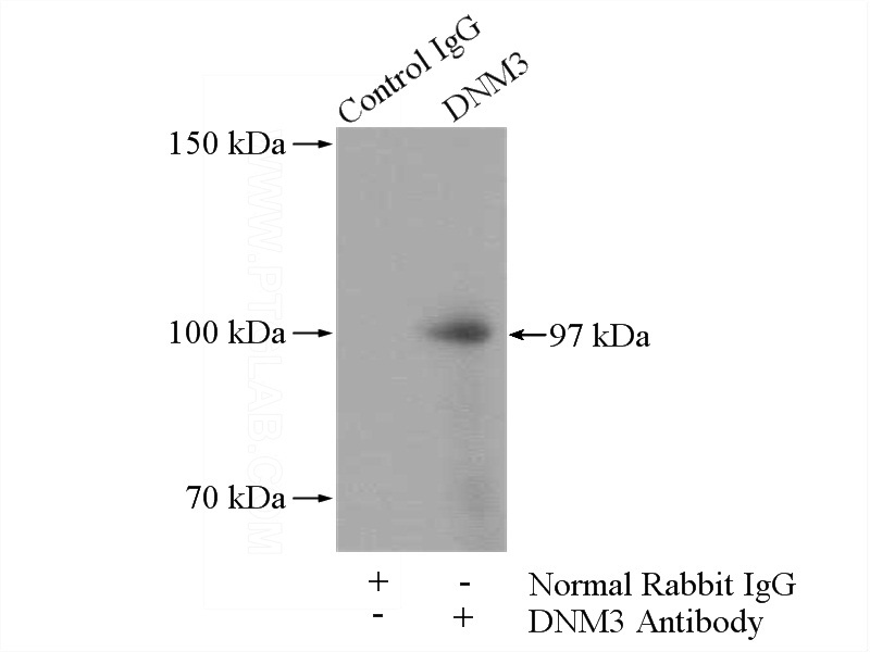 IP Result of anti-DNM3 (IP:Catalog No:109964, 4ug; Detection:Catalog No:109964 1:500) with mouse brain tissue lysate 2640ug.