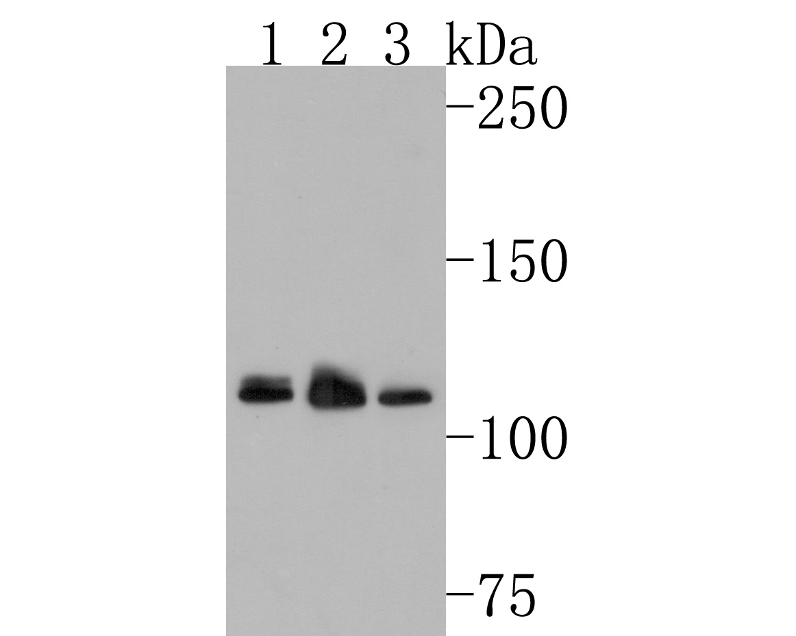 Fig1:; Western blot analysis of RNF111 on different lysates. Proteins were transferred to a PVDF membrane and blocked with 5% NFDM/TBST for 1 hour at room temperature. The primary antibody ( 1/500) was used in 5% NFDM/TBST at room temperature for 2 hours. Goat Anti-Rabbit IgG - HRP Secondary Antibody (HA1001) at 1:200,000 dilution was used for 1 hour at room temperature.; Positive control:; Lane 1: K562 cell lysate; Lane 2: 293T cell lysate; Lane 3: Hela cell lysate