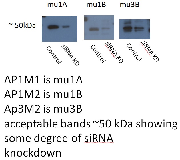 WB resut of AP1M1 antibody (Catalog No:108117, 1:500) with siRNA cell lysate.