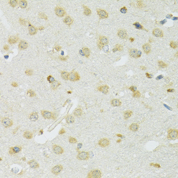 Immunohistochemistry - SLC37A4 Polyclonal Antibody 