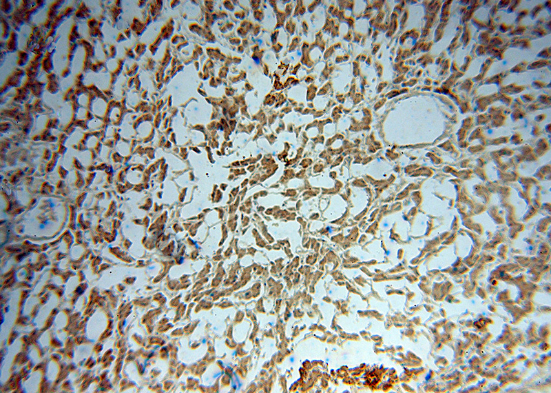 Immunohistochemical of paraffin-embedded human liver using Catalog No:117112(BDH1 antibody) at dilution of 1:50 (under 10x lens)