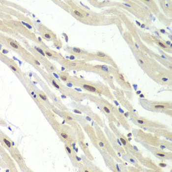 Immunohistochemistry - UPF1 Polyclonal Antibody 