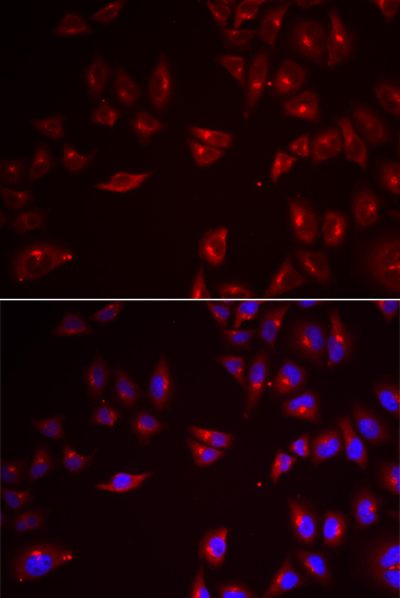 Immunofluorescence - PRAME Polyclonal Antibody 