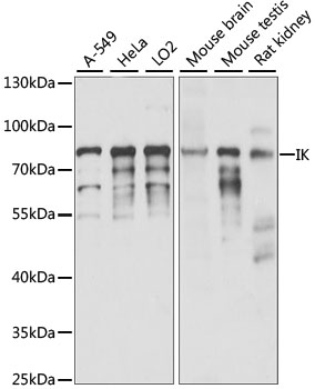 Western blot - IK Polyclonal Antibody 