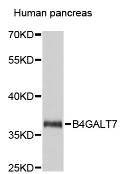 Western blot - B4GALT7 Polyclonal Antibody 