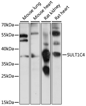 Western blot - SULT1C4 Polyclonal Antibody 